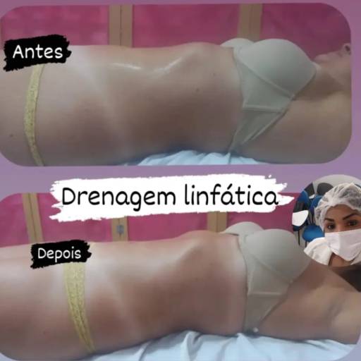  Drenagem Linfática - Revitalize seu Corpo no Rio de Janeiro/RJ por Encanto Estética