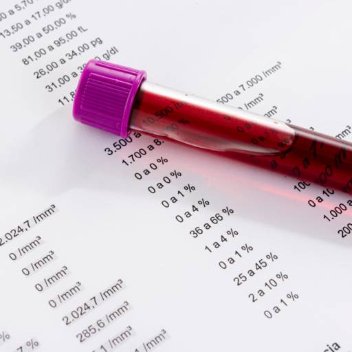 Exame de Glicemia em Bauru