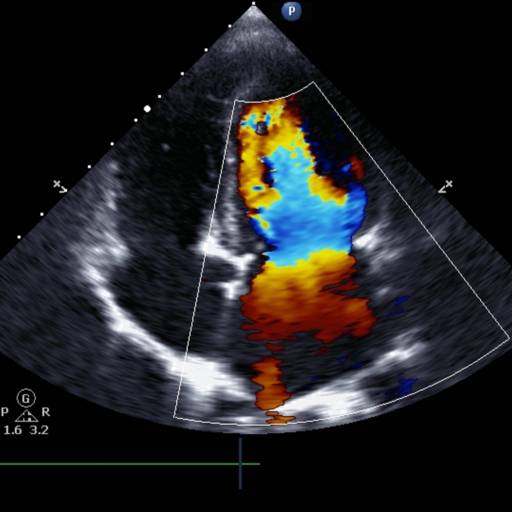 Doppler isolado de Órgãos e Estruturas por Illuminare Clínica Médica e Diagnóstico Por Imagem 