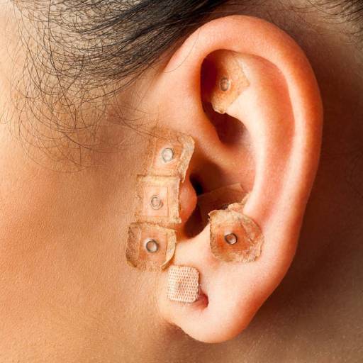 Auriculoterapia por Efatá SPA e Terapias
