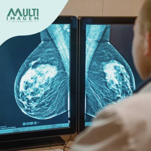 Comprar o produto de Mamografia em Exames  pela empresa Multi Imagem Diagnósticos em Foz do Iguaçu, PR por Solutudo