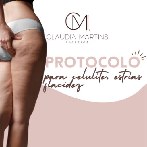 Protocolo para Celulite, estrias e flacidez por Claudia Martins Estética