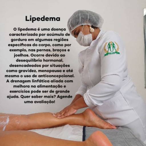  Tratamento de Lipedema - Alívio e Conforto no Rio de Janeiro/RJ por Encanto Estética
