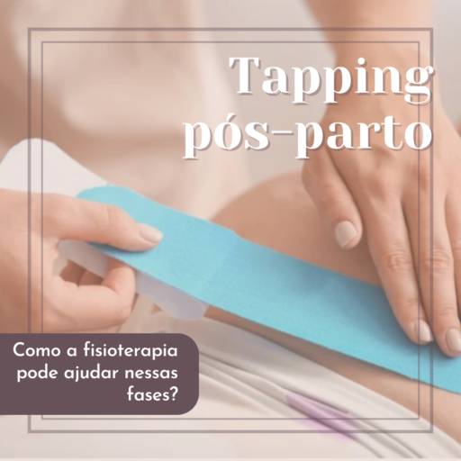 Comprar o produto de Tapping no pós parto em Bauru em Fisioterapia pela empresa Marina Cantú Fisioterapia Pélvica e Pilates em Bauru, SP por Solutudo