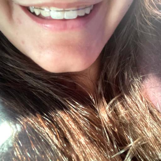 Melhor dentista para aparelho ortodôntico em Itapetininga por OdontoCompany -  Excelência em Odontologia em Itapetininga