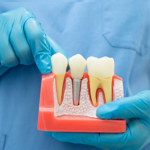 Tratamento de Canal com Microscopia em Niterói: Precisão e Conforto Garantidos