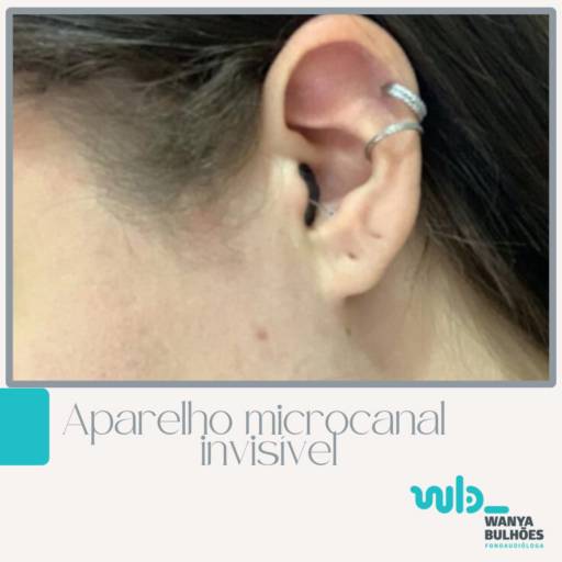 Aparelho Microcanal Invisivel