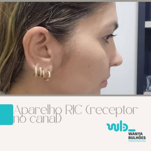 Aparelho Auditivo - RIC