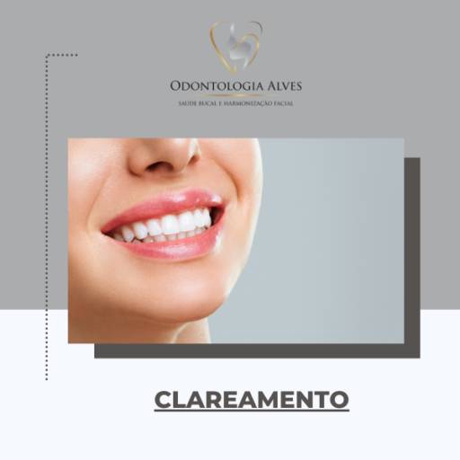 Fazer Clareamento no dente em Itapetininga