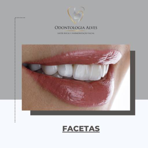 Colocar lente de contato no dente em Itapetininga