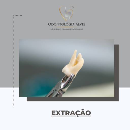 Extrair dente em Itapetininga
