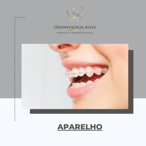 Melhor Dentista para colocar aparelho em Itapetininga