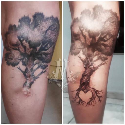 Camuflagem de Cicatriz em Contagem – Tatuagem Reparadora, Estética e Segura na Mya Lobattoo Tattoo