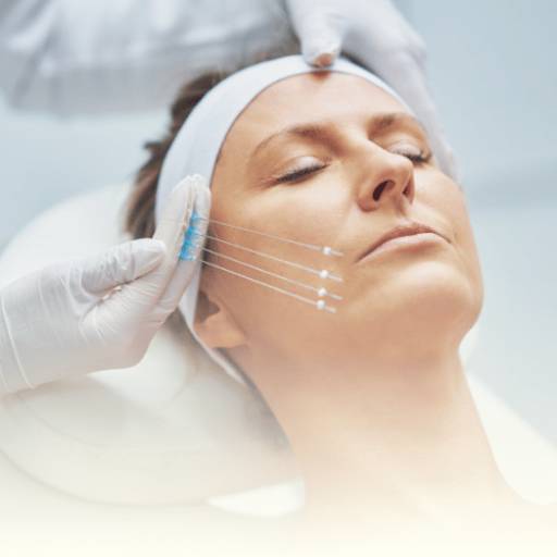 Tratamento com fios por EGB Clinique - Clínica de Estética Avançada