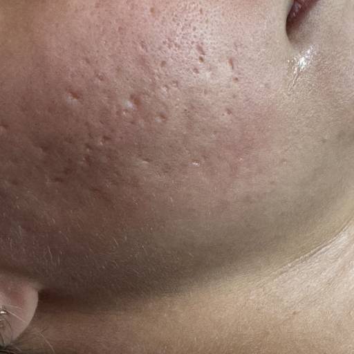 Cuidados com a Pele – Rejuvenescimento e Bem-Estar em Avaré, SP