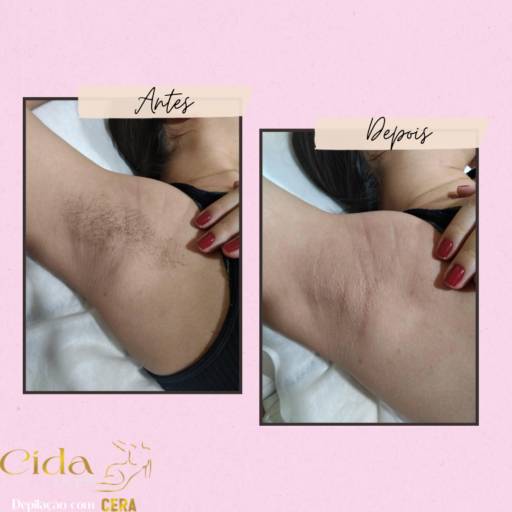 Depilação Axila  por Espaço Cida Depil
