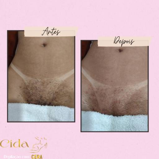 Depilação Virilha  por Espaço Cida Depil