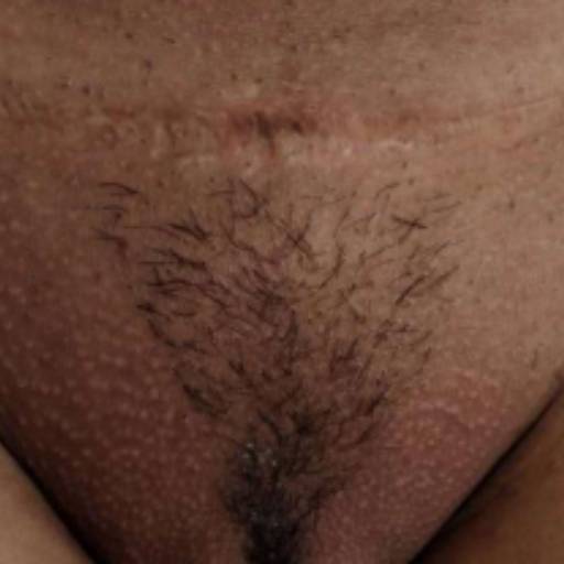 Depilação Virilha  por Espaço Cida Depil