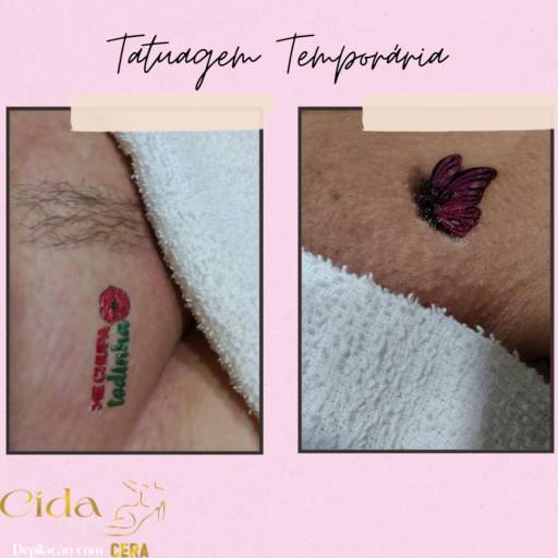 Depilação com Tatuagem Temporária 