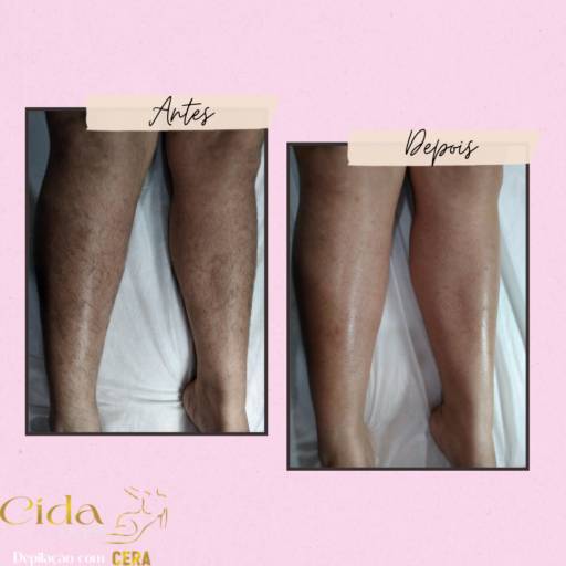 Depilação Pernas 