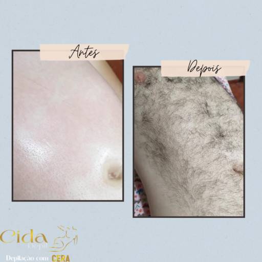 Depilação Abdômen  por Espaço Cida Depil