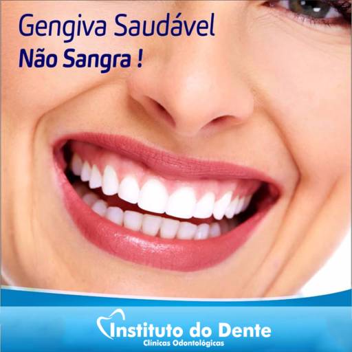 Comprar o produto de GENGIVOPLASTIA em Odontologia pela empresa Instituto do Dente em Marília, SP por Solutudo