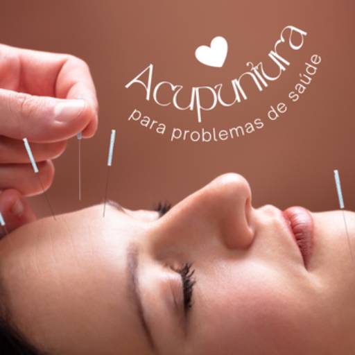 Acupuntura em Americana – Tradição chinesa no alívio de dores e equilíbrio energético