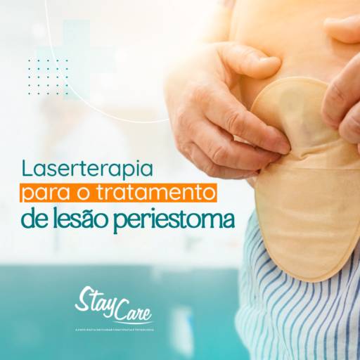 Laserterapia para o tratamento de lesão periestoma 