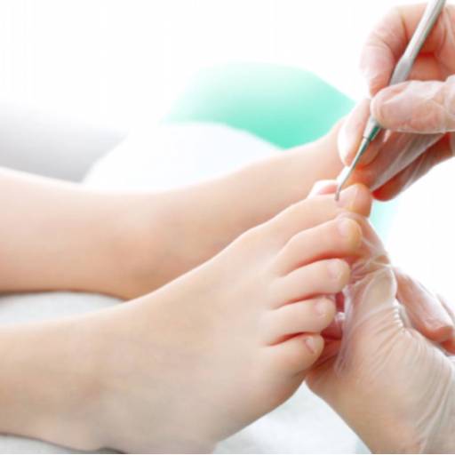 Tratamento para Unhas Encravadas por Clinica Gander Podologia e Reflexologia