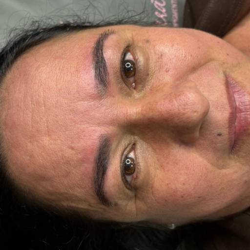 Remoção de Sobrancelhas Tatuadas e Escuras a Laser em Goiatuba por Márcia Guimarães Estética e Micropigmentação