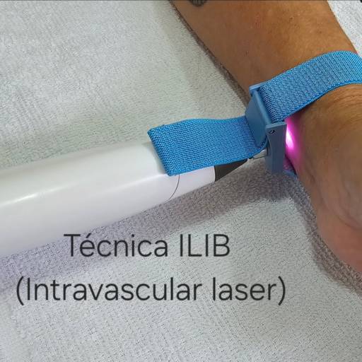 Técnica ILIB em São Manuel – Equilíbrio e Saúde com Terapia a Laser por Saúde Viva e Estética