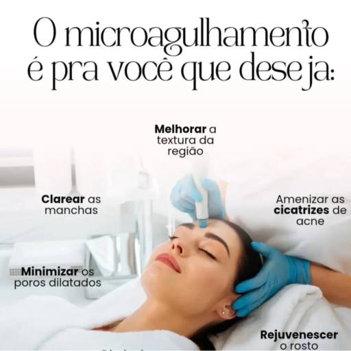 Microagulhamento em São Manuel – Rejuvenescimento com Resultados Visíveis por Saúde Viva e Estética