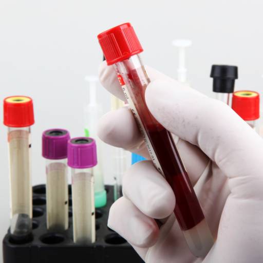 Exames Laboratoriais