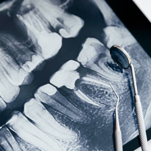 Rx Interproximal - Diagnóstico Preciso e Eficiente em Lençóis Paulista, SP