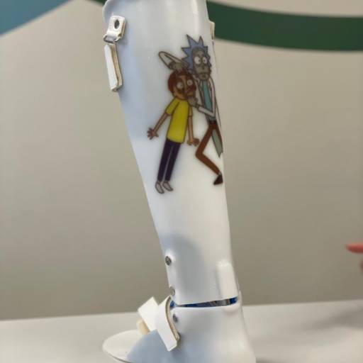 Órtese Suropodálica Articulada Infantil Personalizada - Melhore a Marcha em Ribeirão Preto/SP