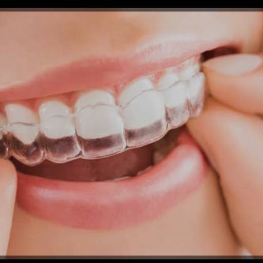 Aparelho Invisível Ortodontia - Liberte-se do Sorriso Metálico - Macatuba