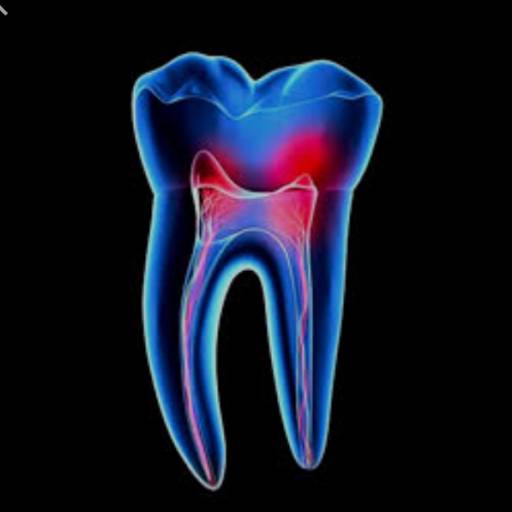 Canal Dentário - Tratamento Endodôntico Rápido e Indolor - Macatuba