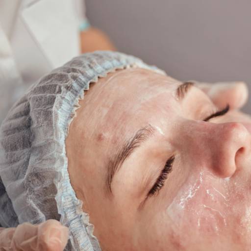 Tratamento para Cicatriz de Acne – Pele Renovada e Confiança em Teresina/PI