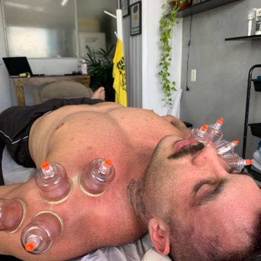 Ventosaterapia em Itu - Restaure o Equilíbrio Energético e Alivie a Tensão Muscular