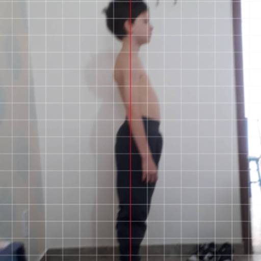 Tratamento de Posturologia para Respiradores Bucais – Saúde e Qualidade de Vida em São José dos Campos/SP por Juliana Savini Fisioterapia e Osteopatia