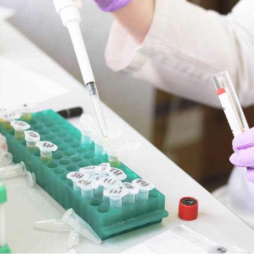 Exames de sangue Birigui