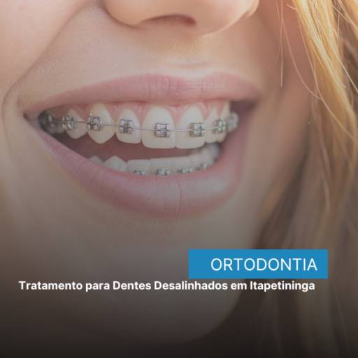 Tratamento para Dentes Desalinhados em Itapetininga 