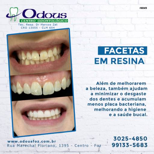 Tratamento Dental  em Foz do Iguaçu, PR por Odous Centro Odontológico