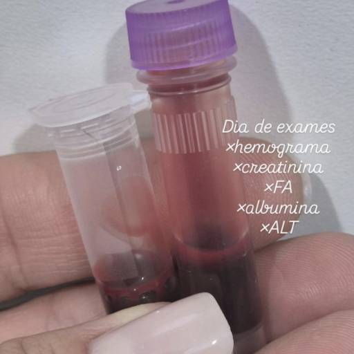EXAME DE SANGUE DE ROTINA, ENDÓCRINOS, SOROLÓGICOS, BIÓPSIAS E OUTROS