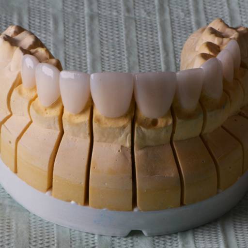 Comprar o produto de LENTES DE CONTATO DENTAL em Saúde Dental pela empresa Clínica Domani - Medicina e Odontologia em Americana, SP por Solutudo