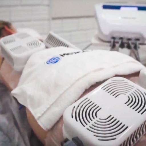 Criolipólise em Aracaju, SE por Estética Anna Paula