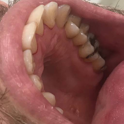 Raspagem Periodontal por Consultório Odontológico Karla Neme Farha