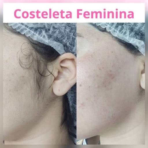 Depilação Costeleta Feminina 