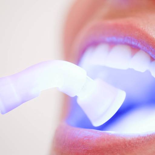 Clareamento Dental a Lazer  por Odous Centro Odontológico