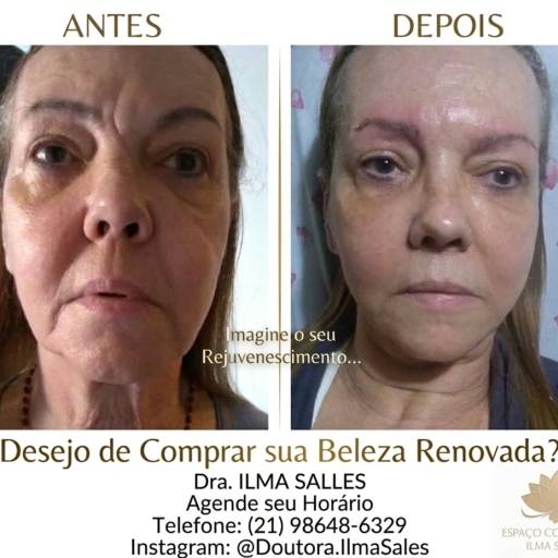 FullFace em Duque de Caxias, RJ, com rejuvenescimento natural